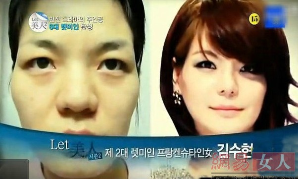 韩国整容节目 丑女迅速变女神